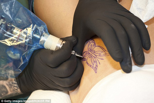 неудачное удаление татуировки