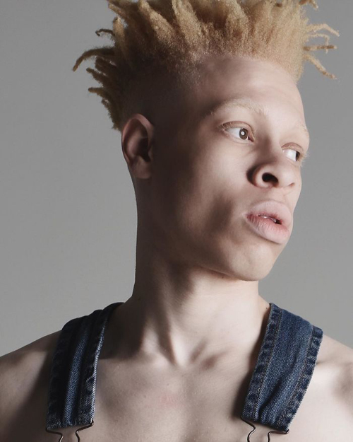 модель с альбинизмом