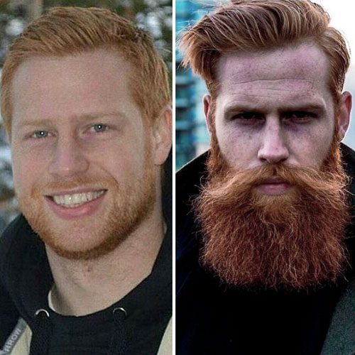 борода изменила жизнь мужчины