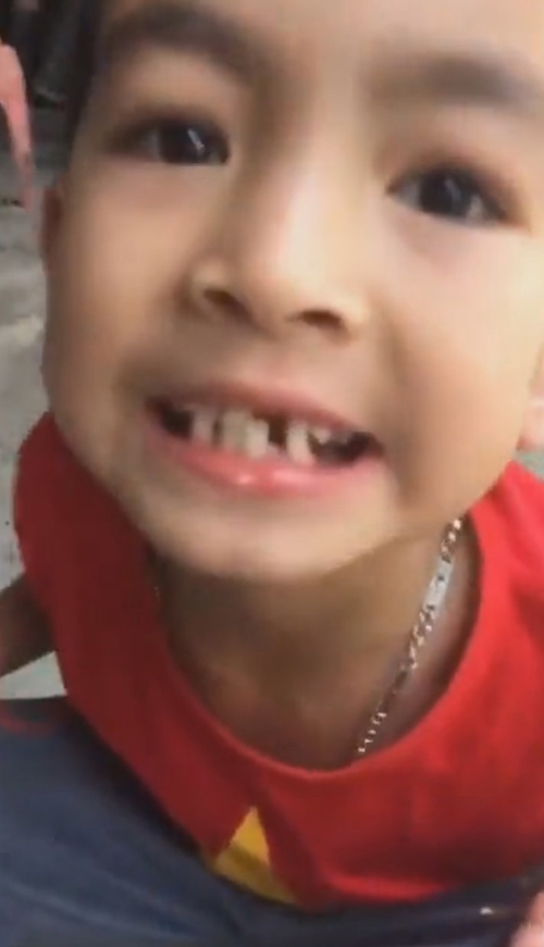 мальчик удалил себе зуб