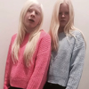 девочки с альбинизмом
