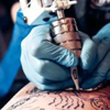 последствия удаления татуировки