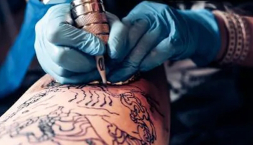 последствия удаления татуировки