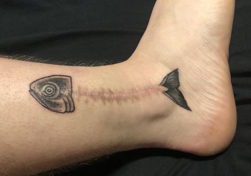 шрамы становятся частью татуировок