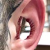 удаление части ушей