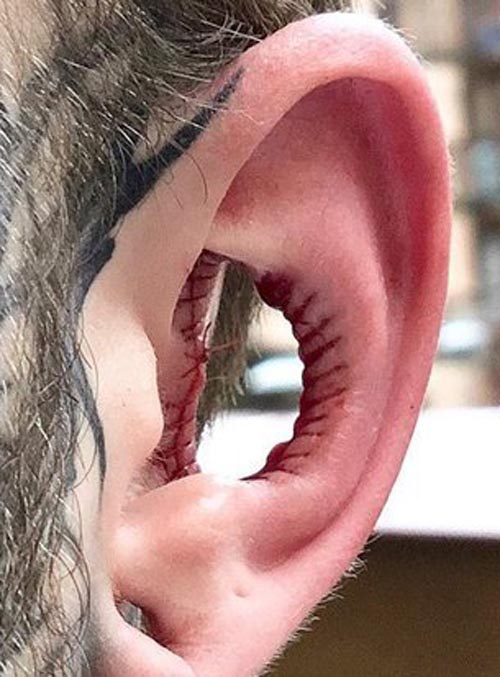 удаление части ушей