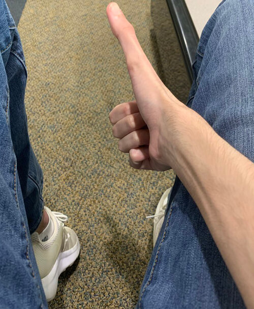 невероятно длинный палец