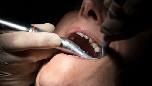 зубные проблемы из-за пандемии