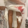 leeches stuck to the bride