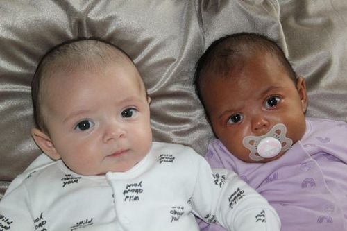 twins with different skin colors
