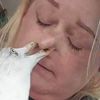 чайка клюнула женщину в нос