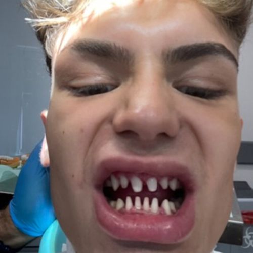 зубы похожи на челюсти акулы