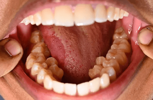 у женщины тридцать восемь зубов