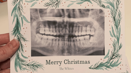 рентгеновский снимок зубов