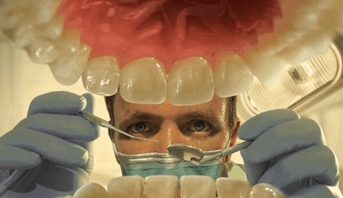 удаление четырех передних зубов 