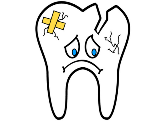 удаление четырех передних зубов