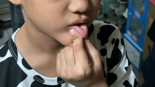 губы детей кололи иголками