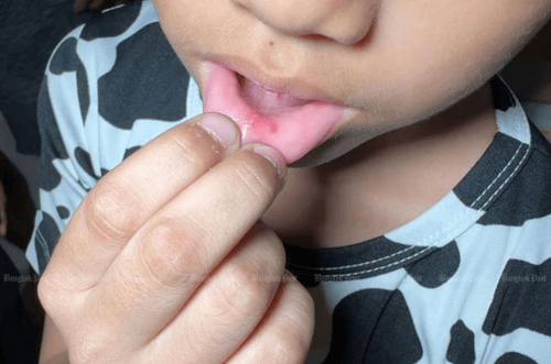 губы детей кололи иголками