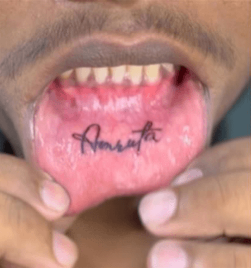 имя на внутренней стороне губы 