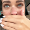 губы сильно распухли 
